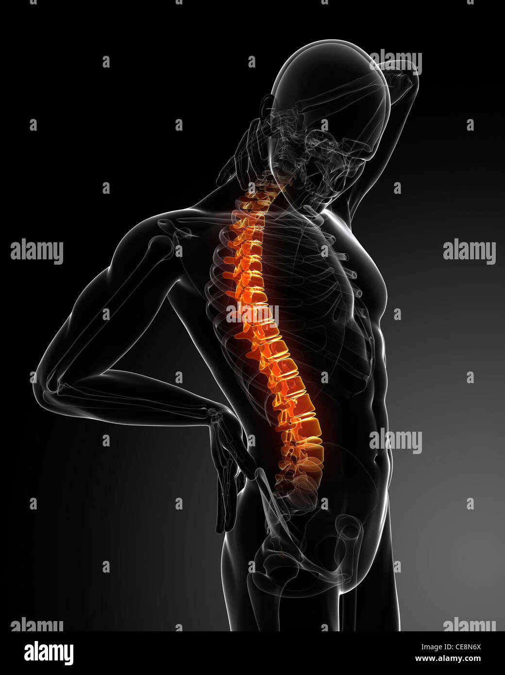 Back pain, conceptual computer artwork Stock Photo - Alamy