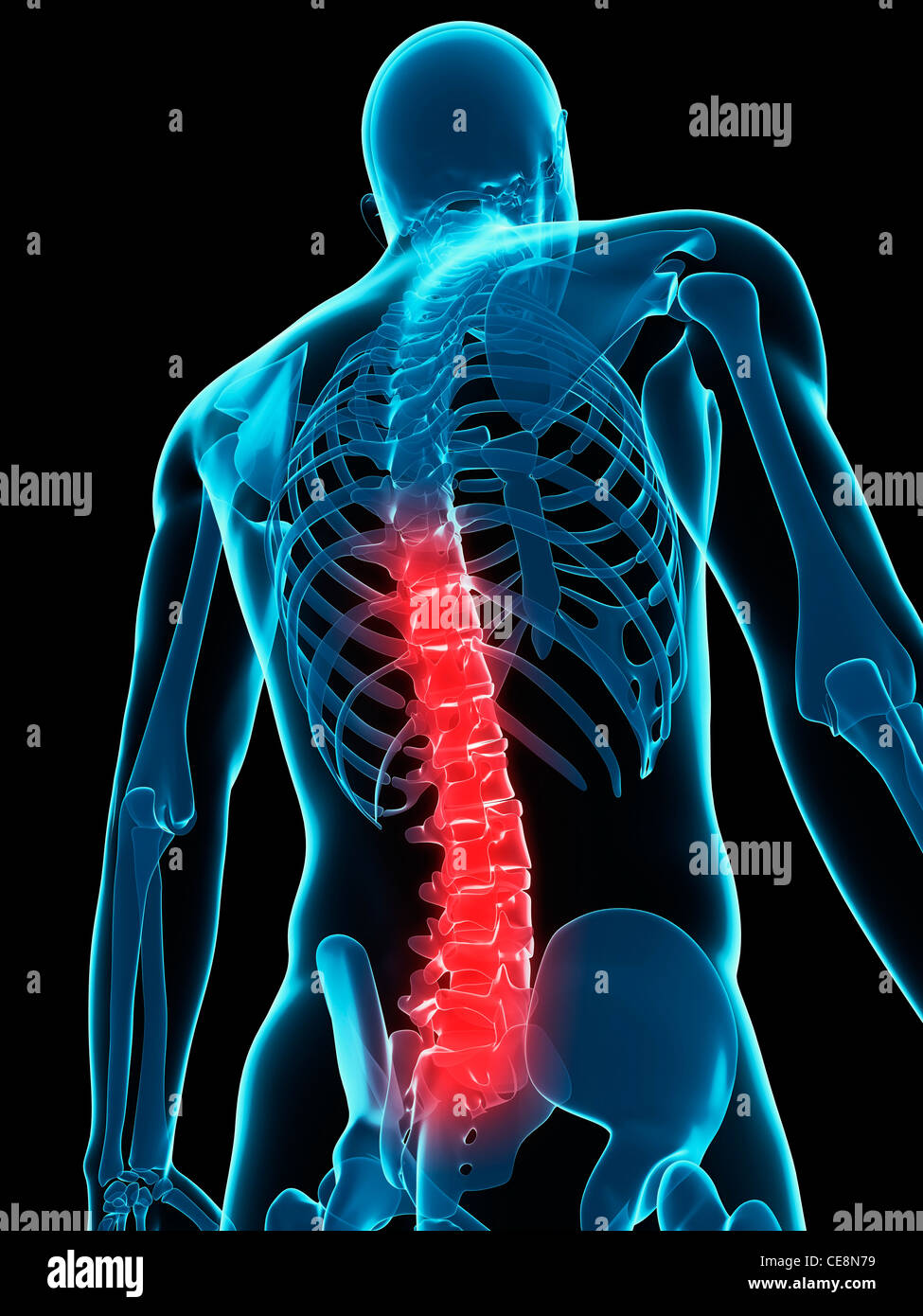 Back pain, conceptual computer artwork Stock Photo - Alamy