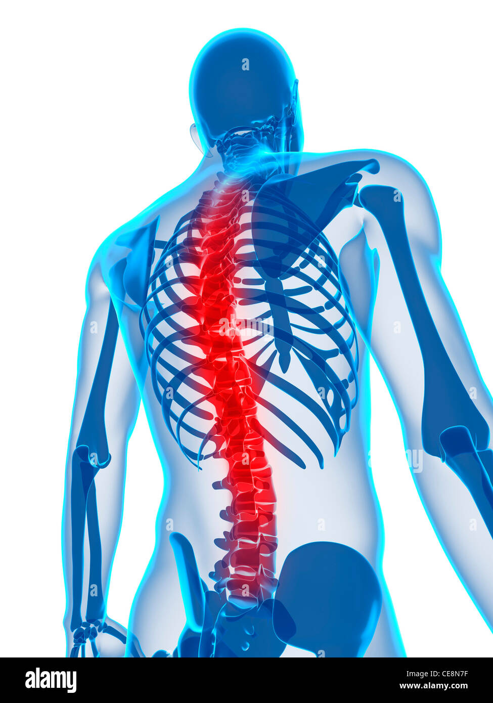 Back pain, conceptual computer artwork Stock Photo - Alamy