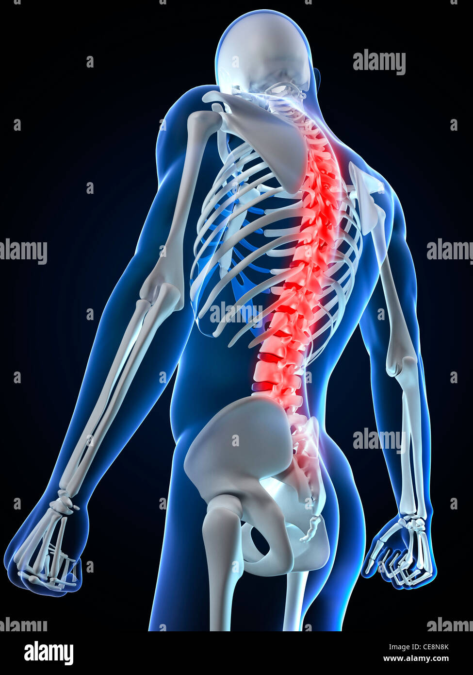 Back pain, conceptual computer artwork Stock Photo - Alamy