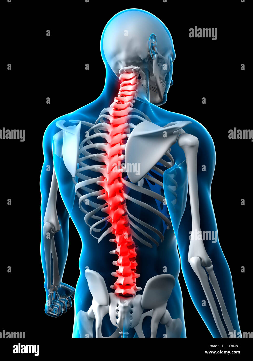 Back pain, conceptual computer artwork Stock Photo - Alamy