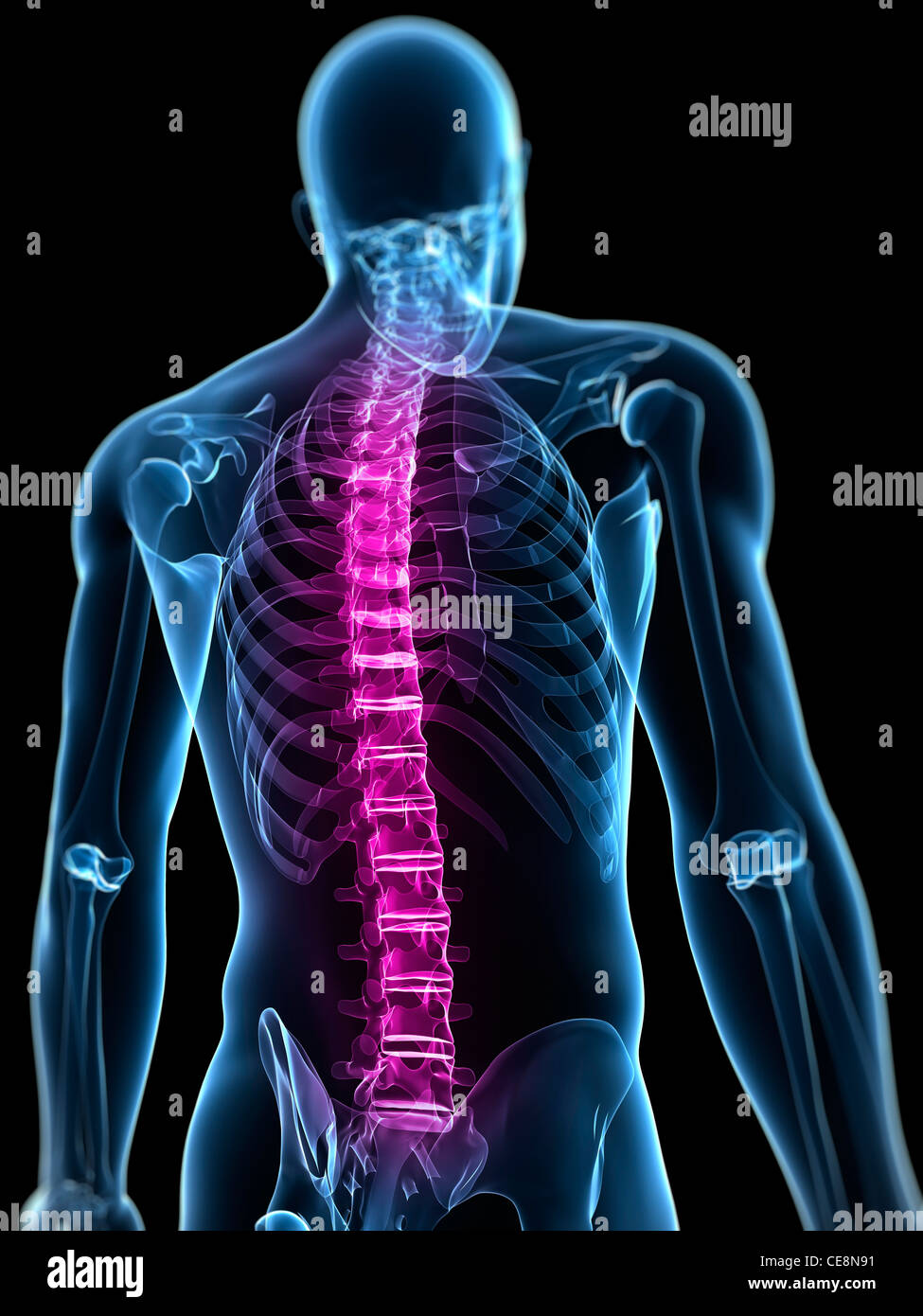 Back pain, conceptual computer artwork Stock Photo - Alamy