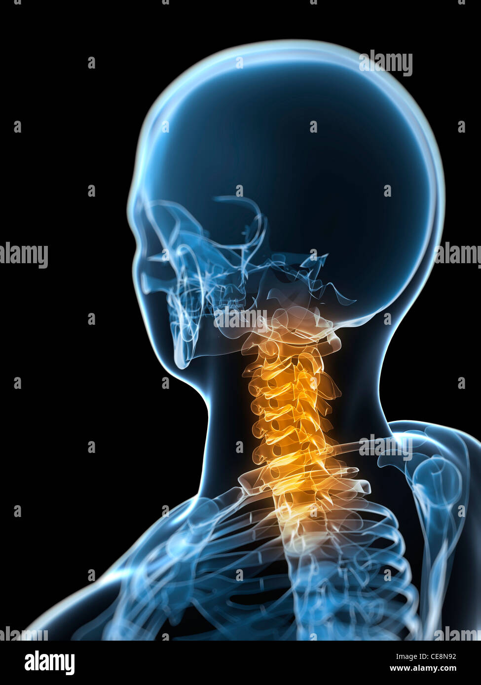 Neck pain, conceptual computer artwork Stock Photo Alamy