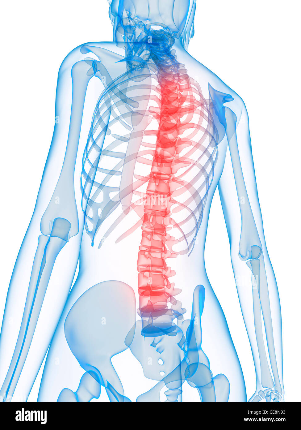 Back pain, conceptual computer artwork Stock Photo - Alamy
