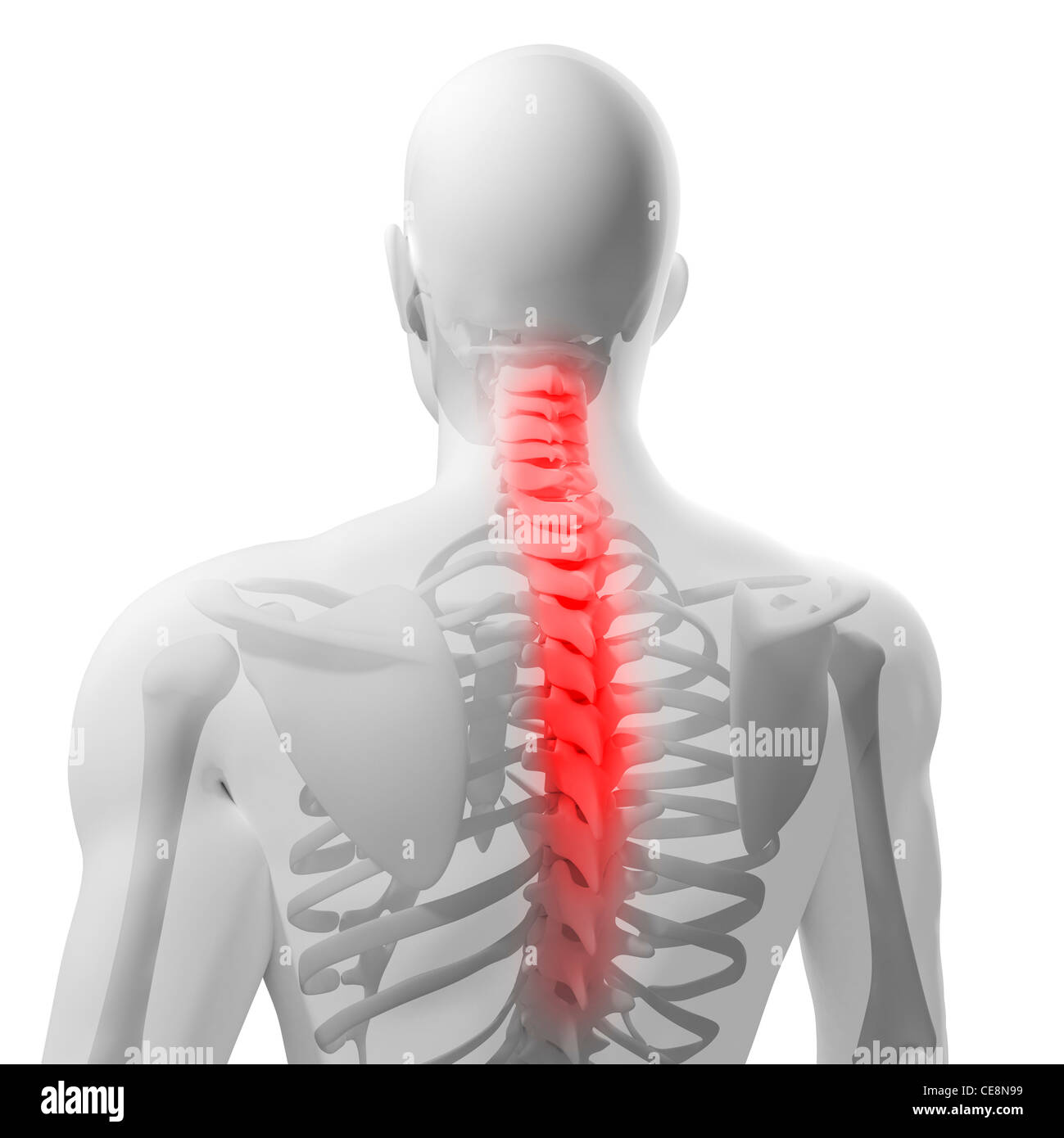 Back pain, conceptual computer artwork Stock Photo - Alamy