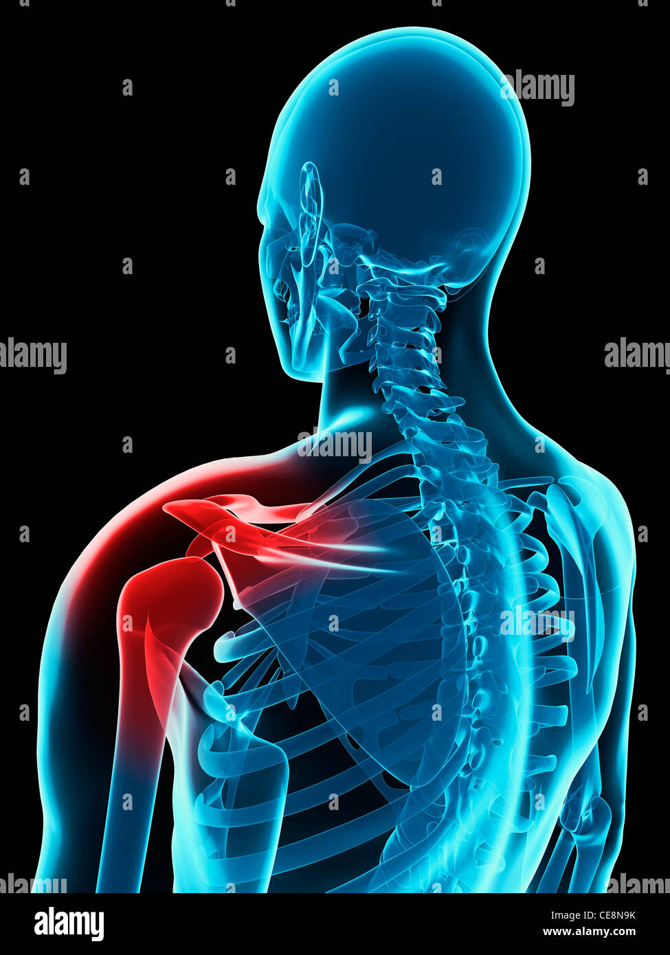 Shoulder pain, conceptual computer artwork Stock Photo Alamy