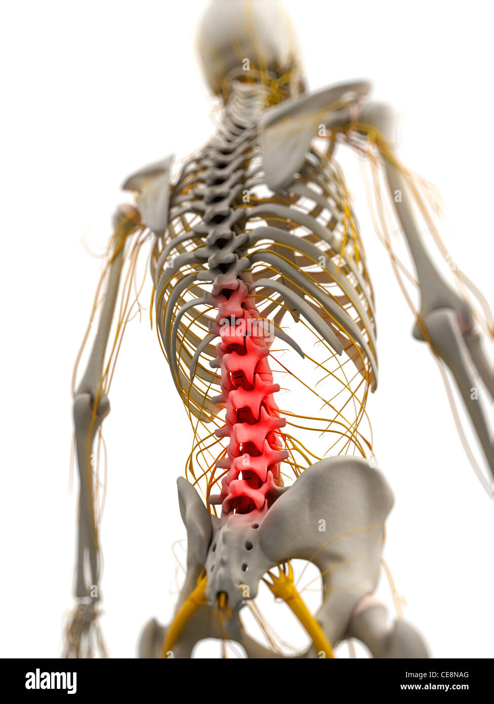 Back pain, conceptual computer artwork Stock Photo - Alamy