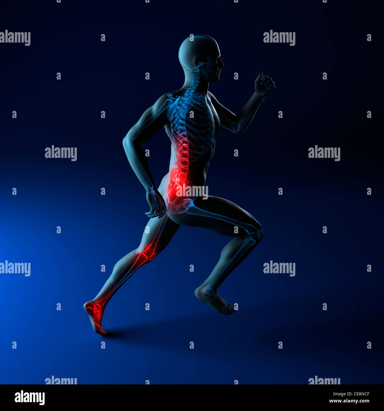 Running injuries, conceptual computer artwork Stock Photo - Alamy