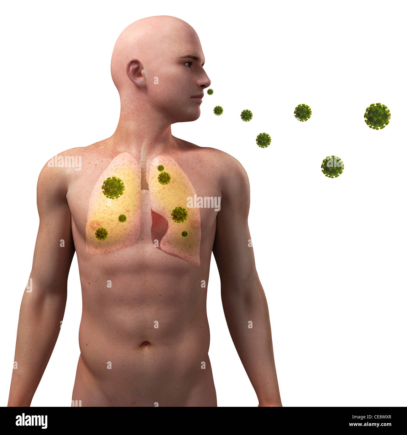 Viral lung infection, conceptual computer artwork. Stock Photo