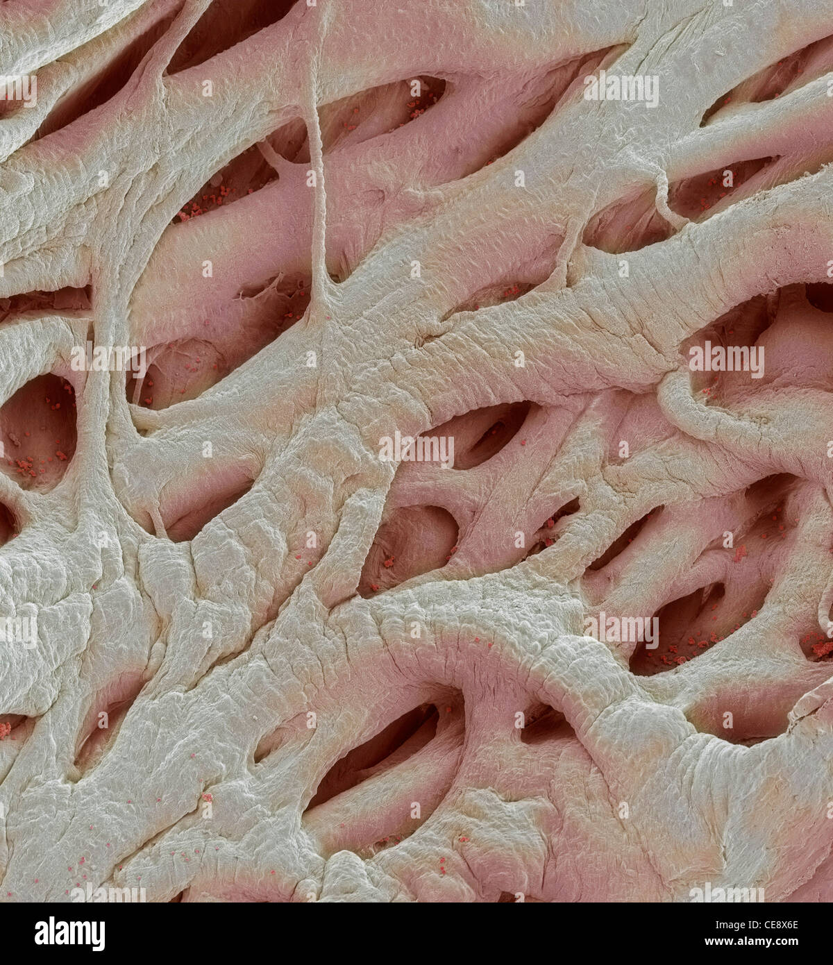 Heart strings coloured scanning electron micrograph SEM heart strings chordae tendineae are cord-like tendons connect papillary Stock Photo