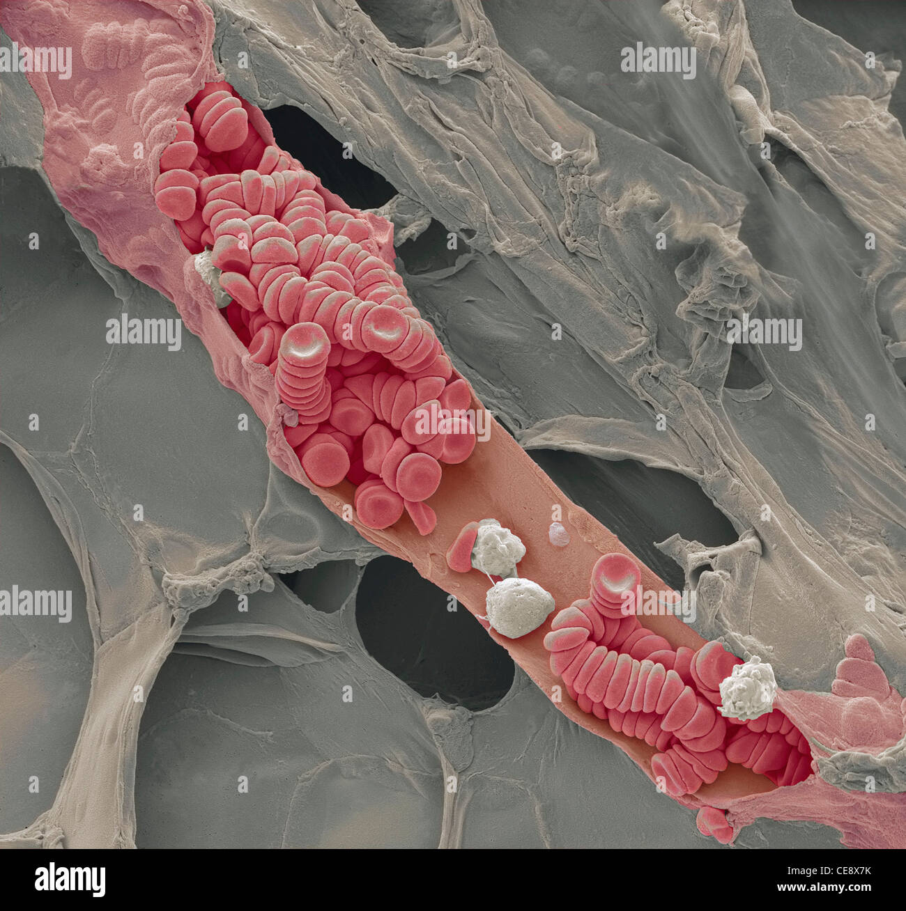 Ruptured venule Coloured scanning electron micrograph SEM ruptured venule running through fatty tissue  Stacked red blood cells Stock Photo