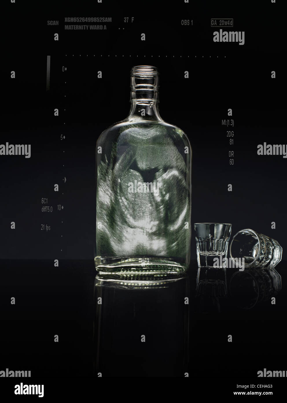 Drinking Alcohol during Pregnancy, 12 week Ultrasound scan of foetus in