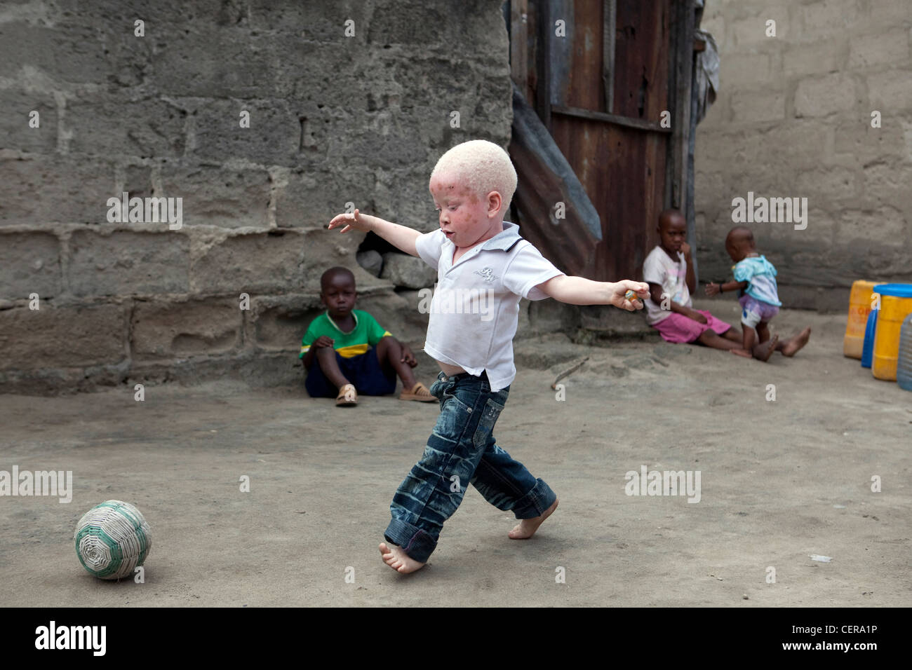 Albino human hi-res stock photography and images - Alamy