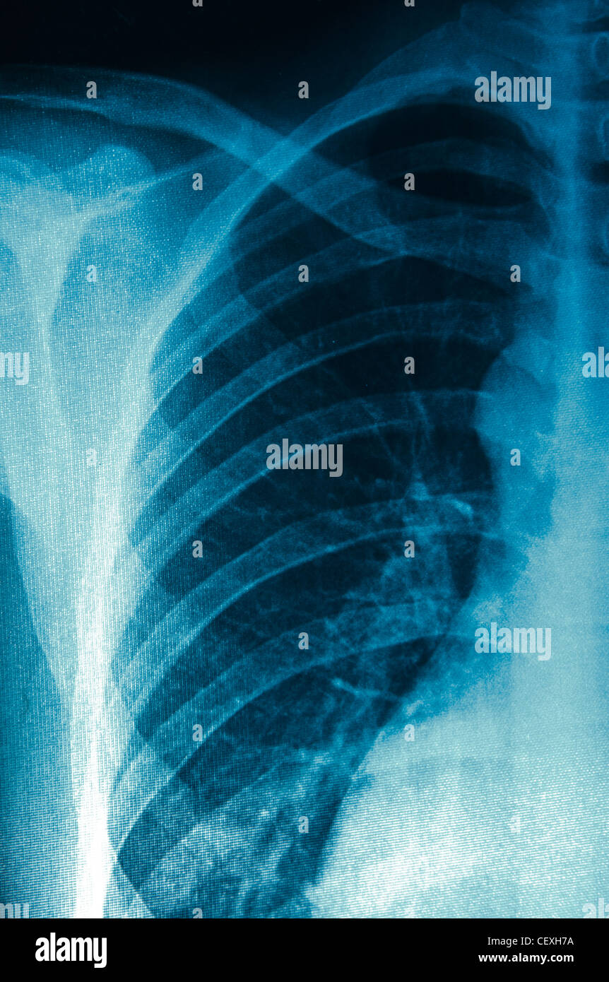 Female chest anatomy hi-res stock photography and images - Alamy