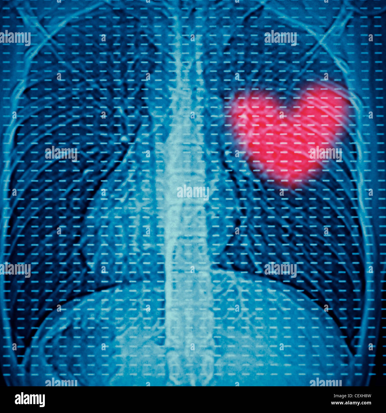 x-ray of human lumbar bone and red heart Stock Photo