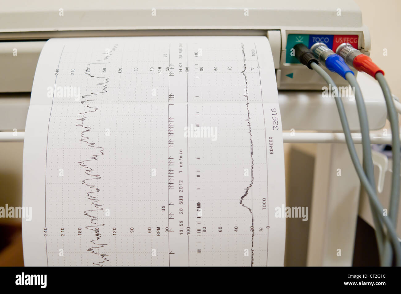 Ecg hi-res stock photography and images - Alamy
