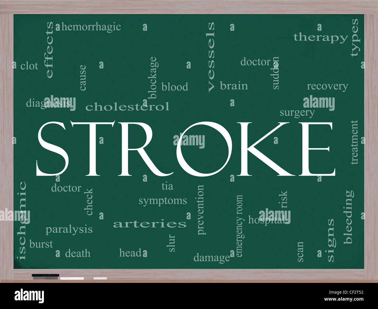Hemorrhagic Stroke High Resolution Stock Photography and Images Alamy