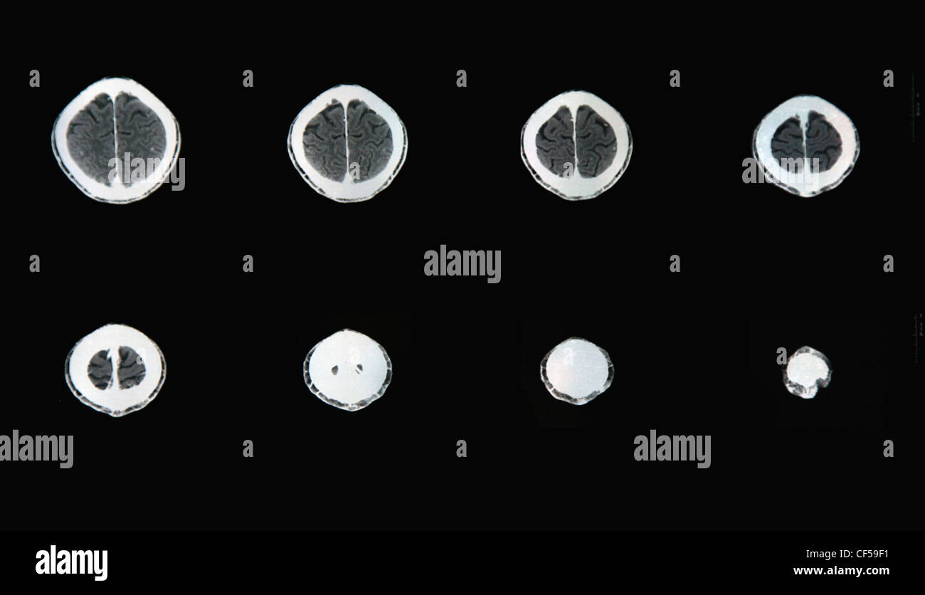 Ct scan report of neck, close up Stock Photo Alamy