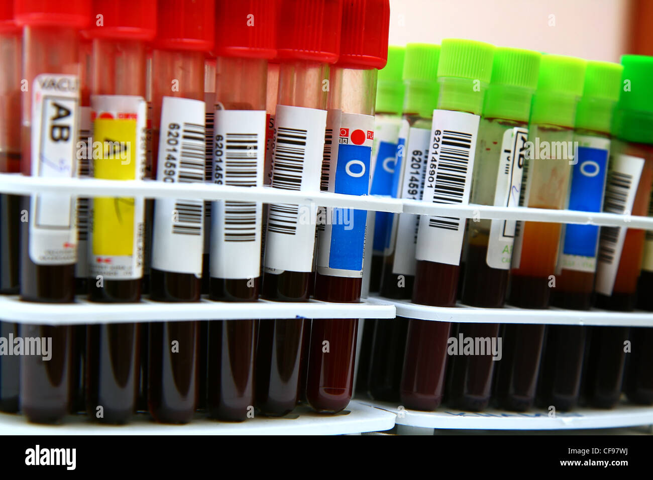 Blood test red tube serum hi-res stock photography and images - Alamy
