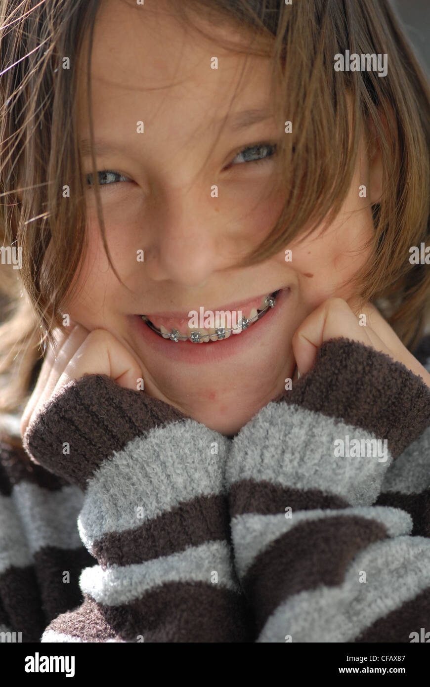 Braces, tooth, teeth, laugh, brace, girl, teenager, dental correction