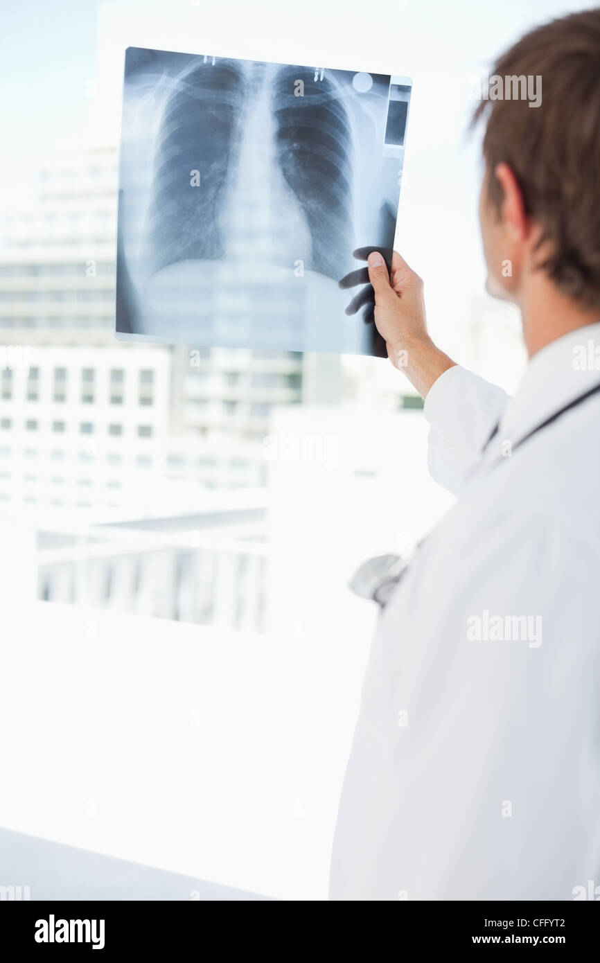 Male chest x ray hi-res stock photography and images - Alamy