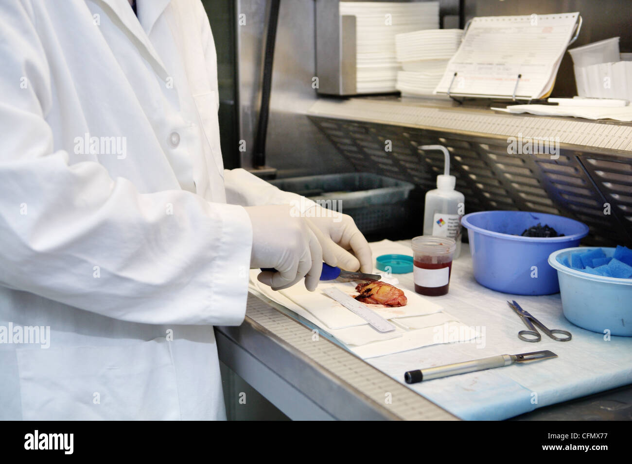 Preparing tissue samples of an appendix to be examined by a pathologist. Stock Photo