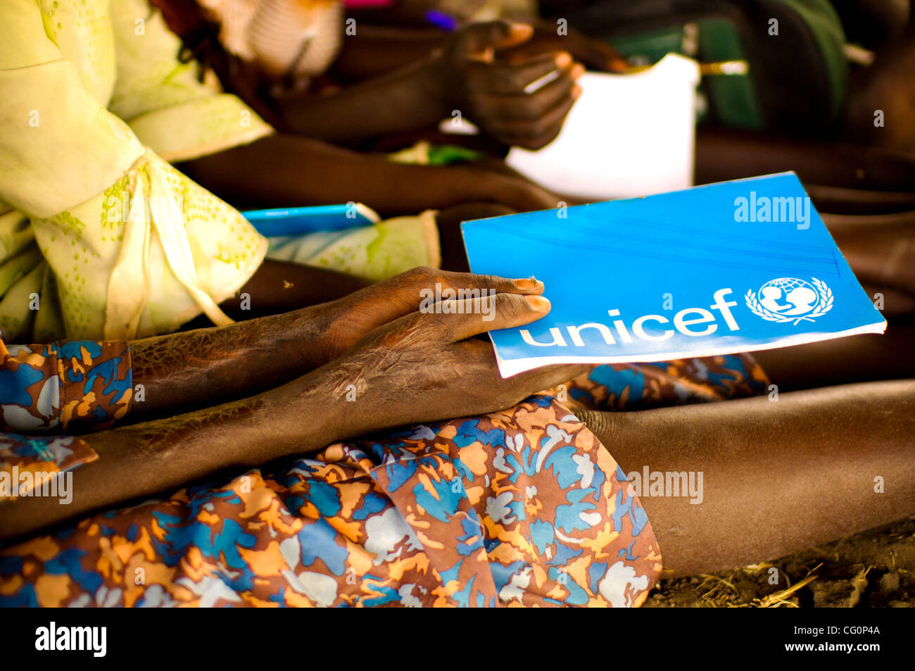Jul. 11, 2007 - Kolmerek, South Sudan - A survivors of the 21-year-long civil war in Southern Sudan, this child's burn marks tell a story of her hardship. (Credit Image: © Micah Albert/zReportage.com/ZUMA) Stock Photo