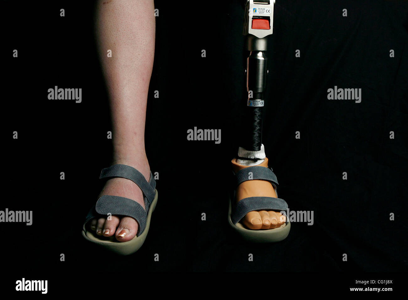 Aug 17, 2007 - Lake Worth, FL, USA - Closeup of leg amputee - this is Elissa Wehner who suffers from Diabetes. (Credit Image: © J. Gwendolynne Berry/Palm Beach Post/ZUMA Press) RESTRICTIONS: USA Tabloid RIGHTS OUT! Stock Photo