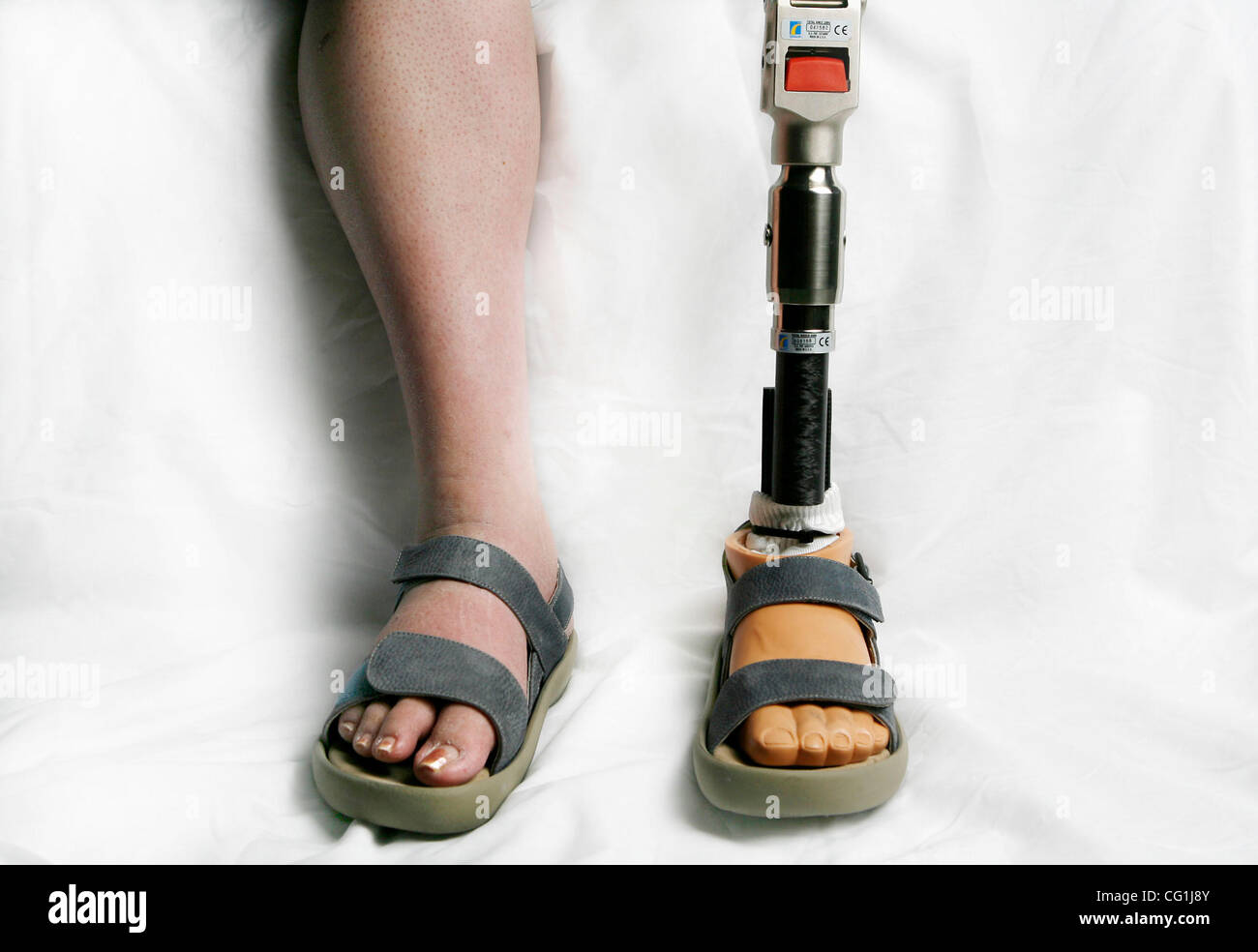 Aug 17, 2007 - Lake Worth, FL, USA - Closeup of leg amputee - this is Elissa Wehner who suffers from Diabetes. (Credit Image: © J. Gwendolynne Berry/Palm Beach Post/ZUMA Press) RESTRICTIONS: USA Tabloid RIGHTS OUT! Stock Photo