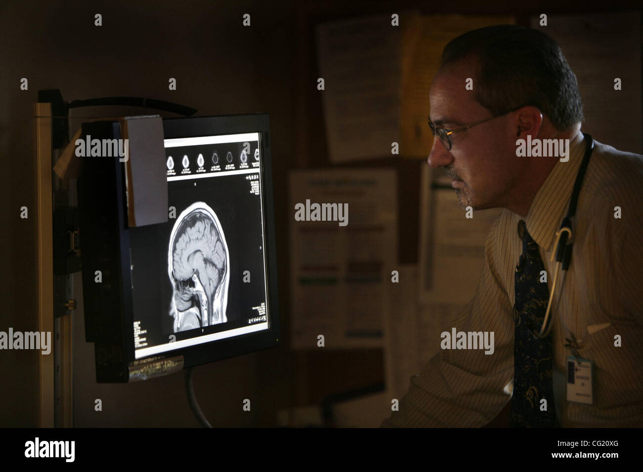 No more light box, Dr. Dan Bolster looks at a X-Ray of a skull on a new monitor at the Woodland Hospital emergency dept. The Woodland Healthcare Foundation has publicly launched a campaign to help pay  $1.5 million in enhancements to Yolo County's primary emergency department. The new items are part Stock Photo