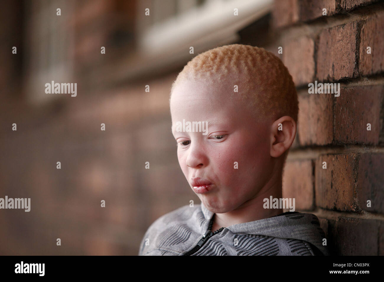 Portrait of albino boy in Siloe School For The Blind in Polokwane, RSA Stock Photo