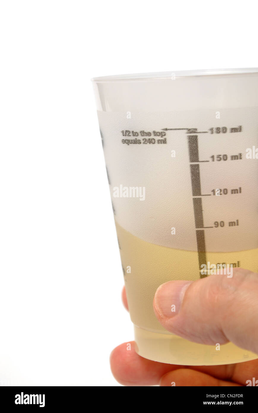 Man holding urine sample Stock Photo Alamy