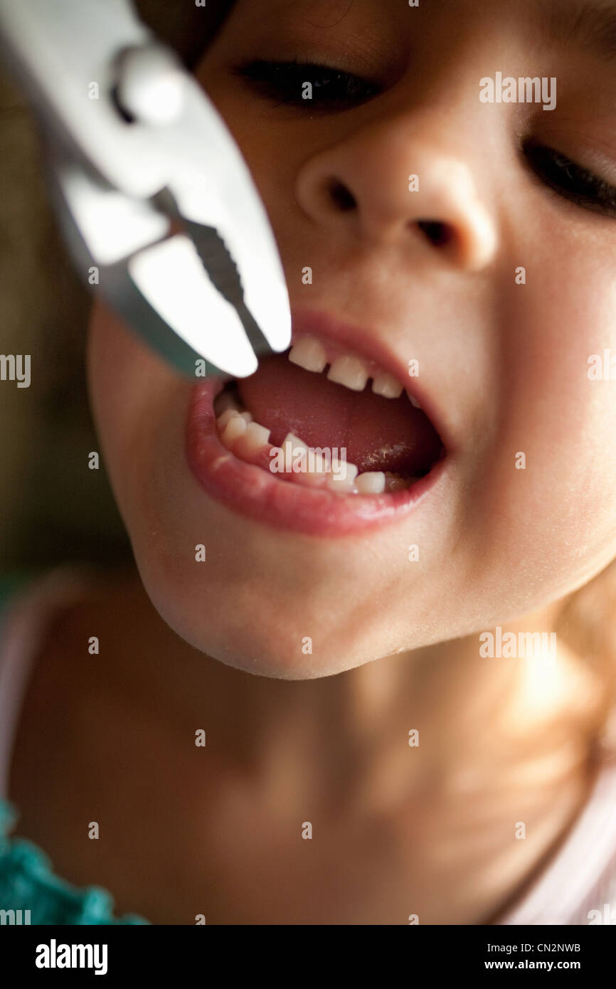 Pulling out tooth hi-res stock photography and images - Alamy
