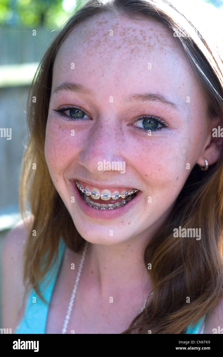 Blonde Teen Braces