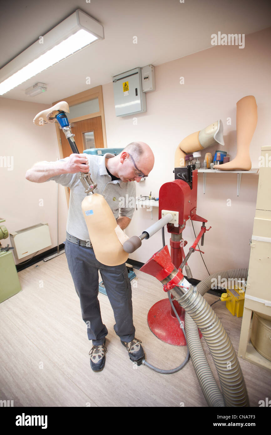 A prosthetic leg manufactured in a hospital workshop UK Stock Photo
