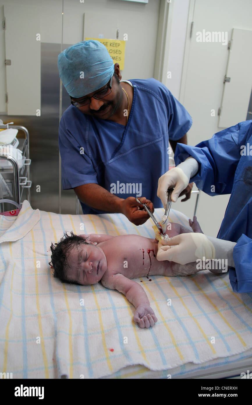 Father cutting umbilical cord of newborn baby shortly after birth Stock ...