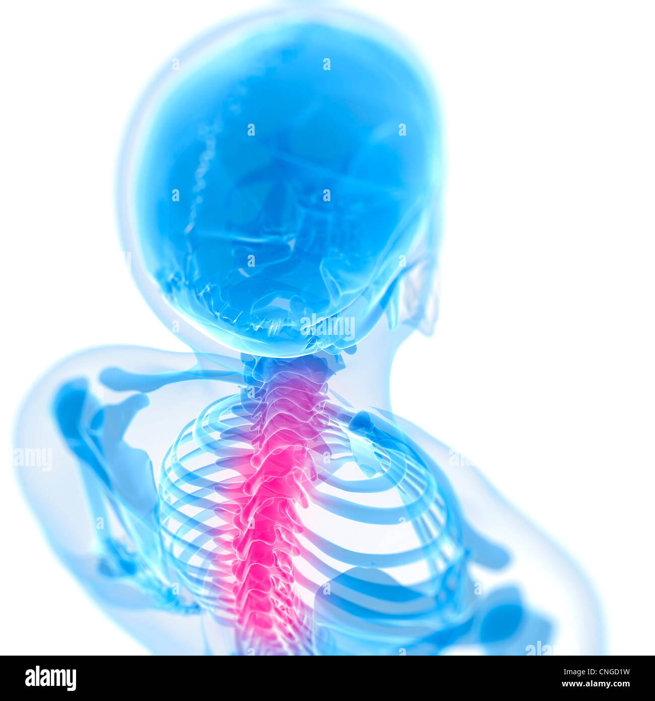 Back pain conceptual artwork Stock Photo - Alamy