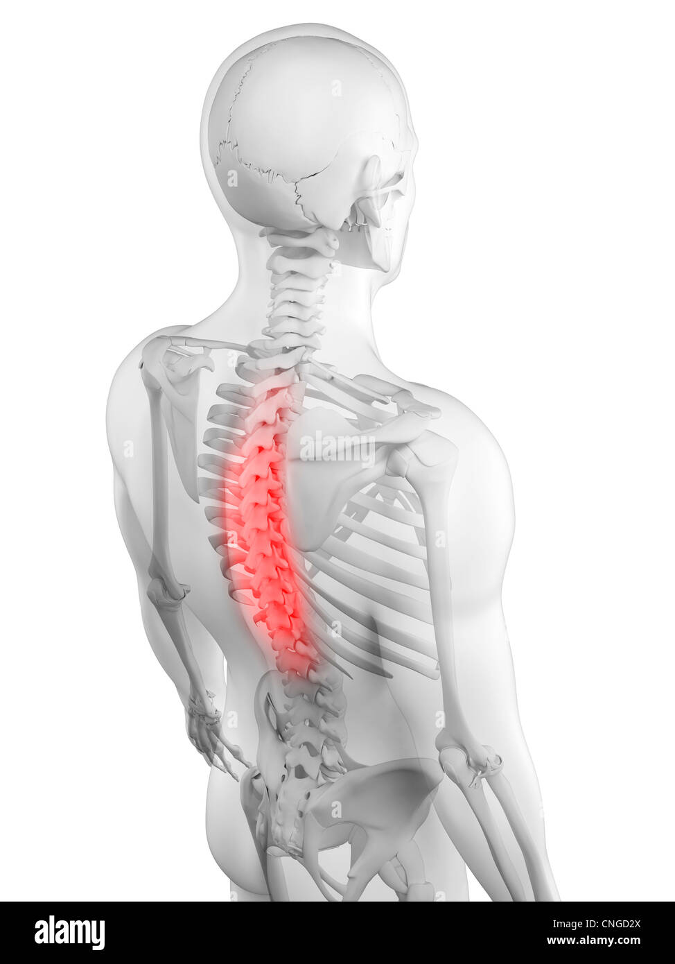 Back pain conceptual artwork Stock Photo - Alamy