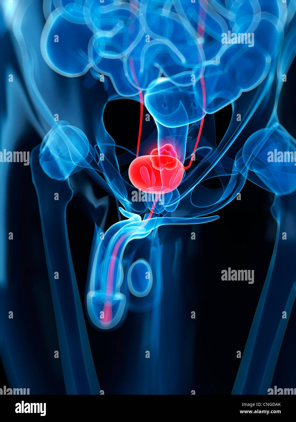 Bladder cancer High Resolution Stock Photography and Images Alamy