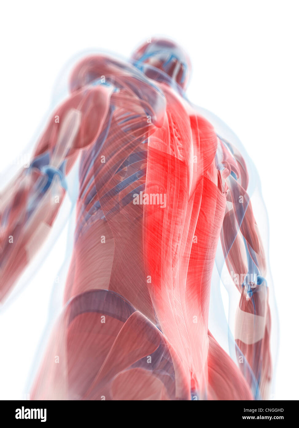 Back pain conceptual artwork Stock Photo - Alamy