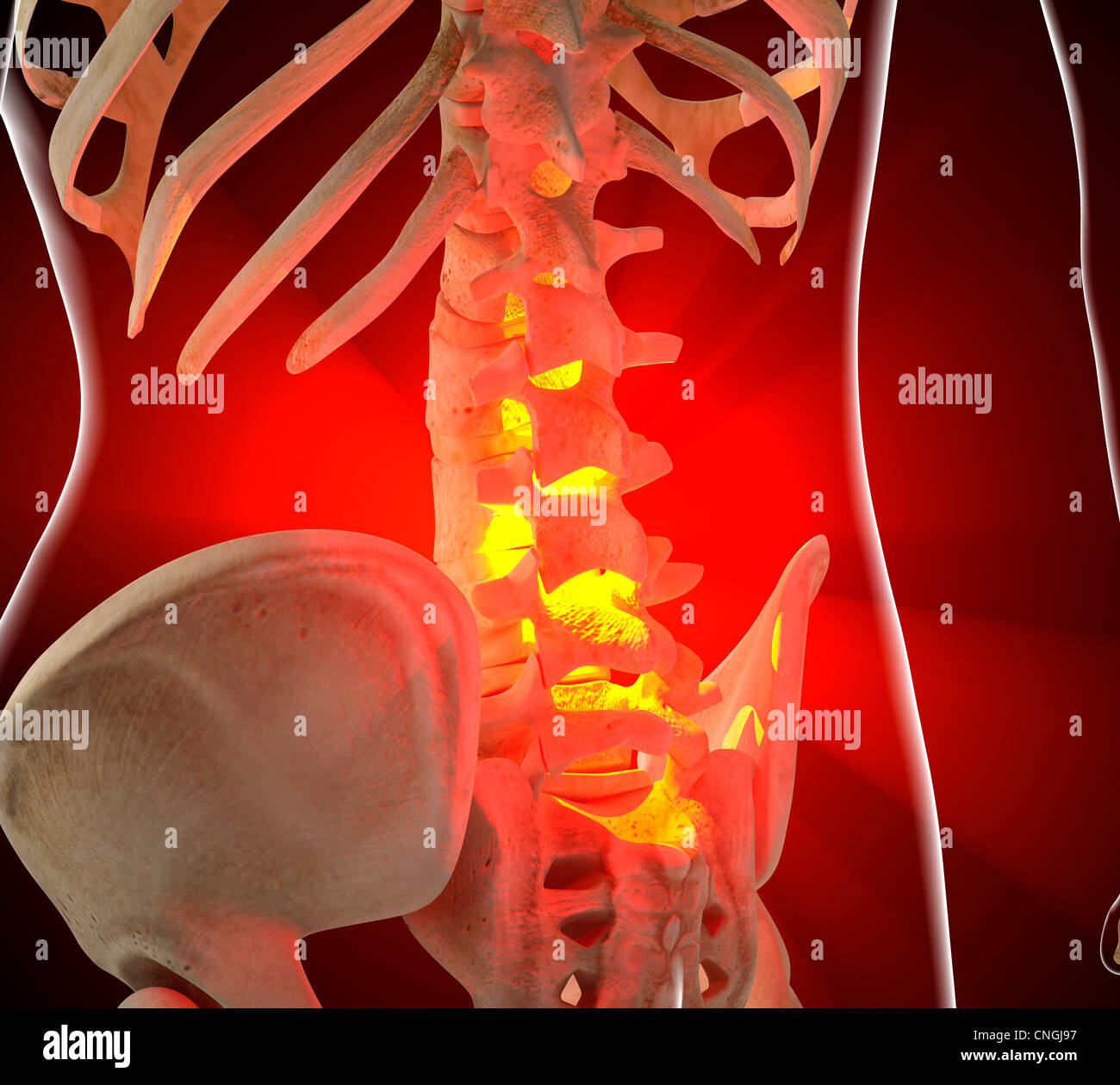 Back pain conceptual artwork Stock Photo - Alamy