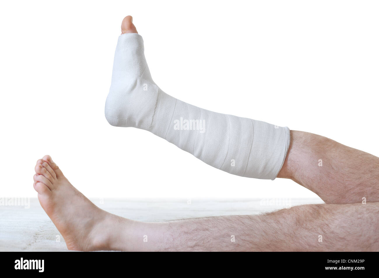 Broken leg man hi-res stock photography and images - Alamy