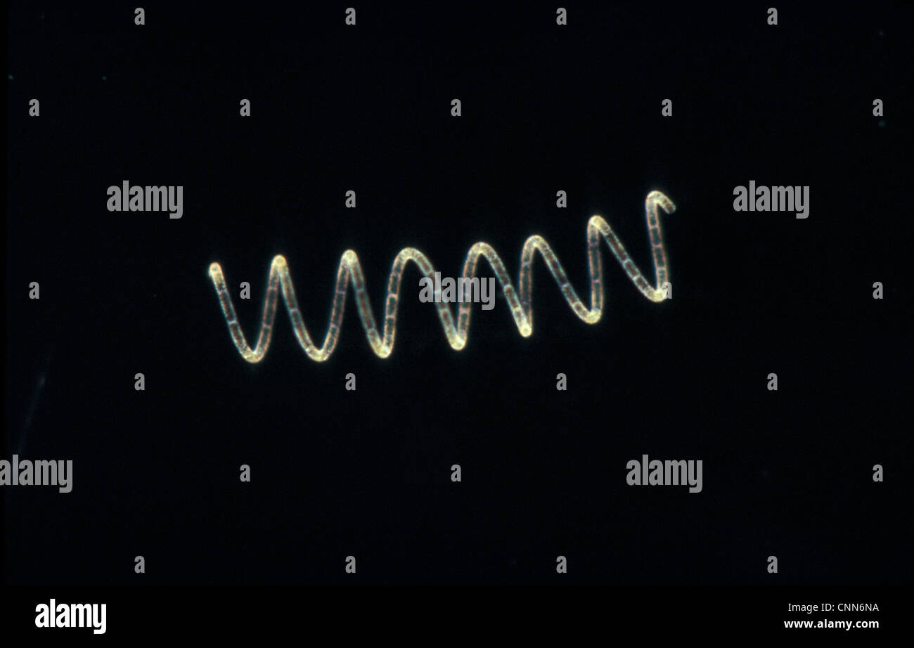 Plankton - Diatom (Rhizosolenia stolterfothii) Individual diatoms unite to form Stock Photo