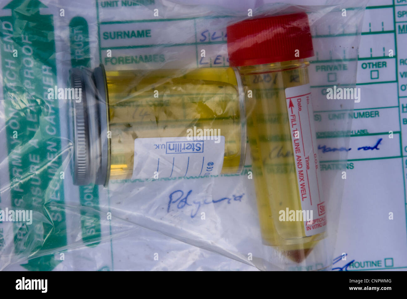 Urine samples in plastic bottles with pathology forms Stock Photo Alamy