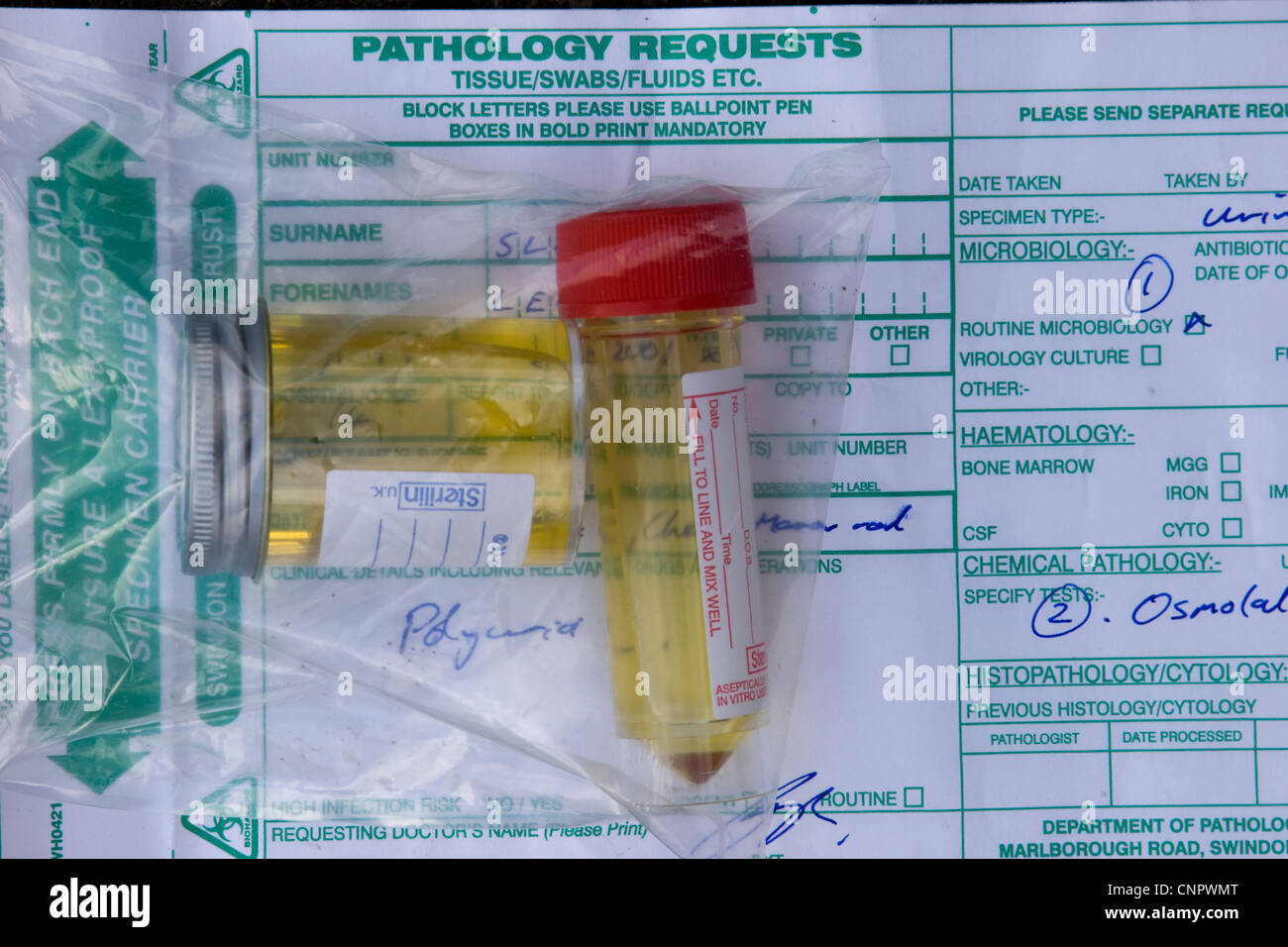Urine samples in plastic bottles with pathology forms Stock Photo Alamy