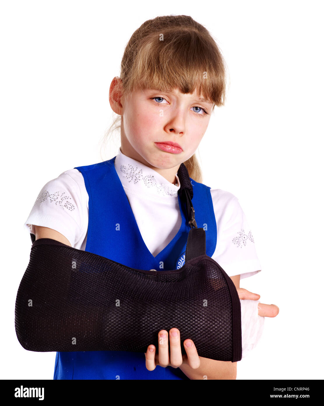 Broken arm in a cast. Isolated Stock Photo Alamy