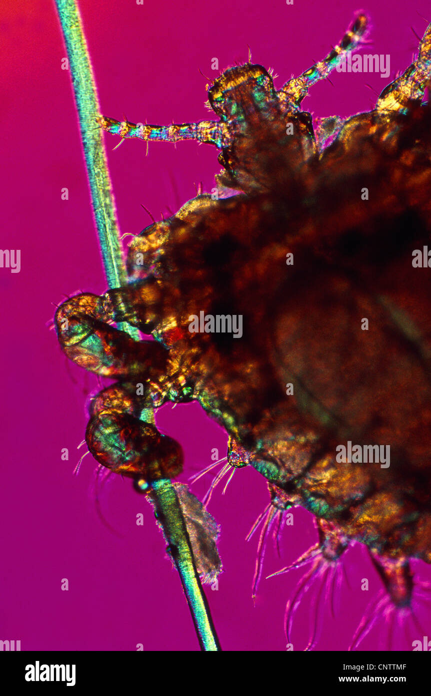 Close up of crab louse on hair Stock Photo