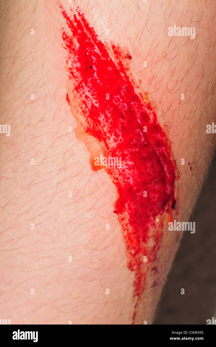 Wound with blood - abrasion Stock Photo