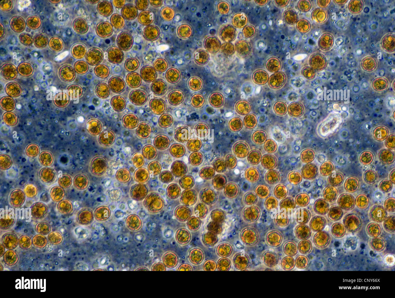 Microscopic photo of symbiotic algae (Zooxanthellae) of the dinoflagellat genus Symbiodinium (syn.: Gymnodinium).  Sampled from a soft coral (Sinularia spec.) Stock Photo