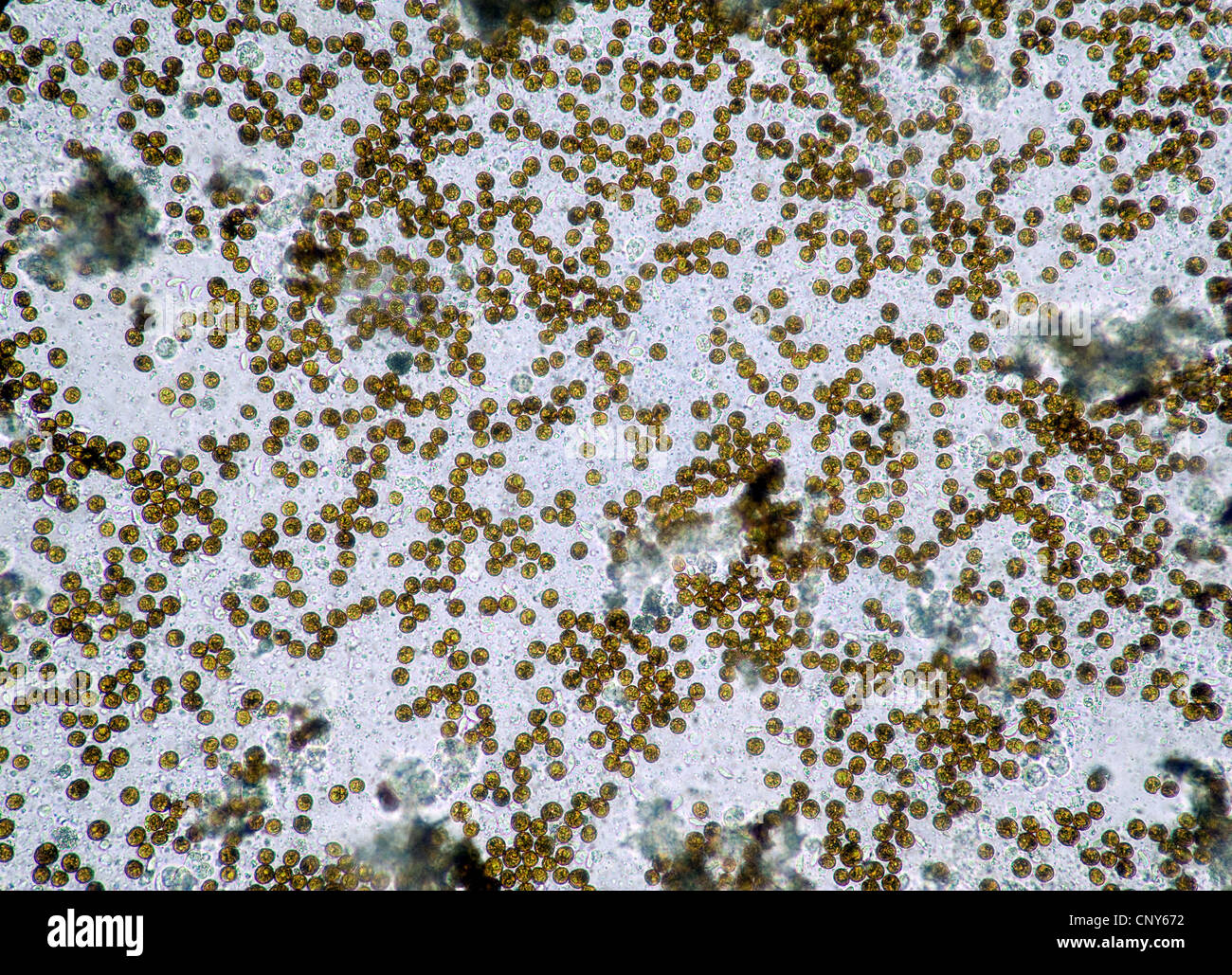 Microscopic photo of symbiotic algae (Zooxanthellae) of the dinoflagellat genus Symbiodinium (syn.: Gymnodinium).  Sampled from a soft coral (Sinularia sp.) Stock Photo